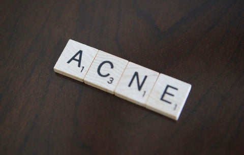 Clear as Day – Bringing to Light the Truths About Acne Scars