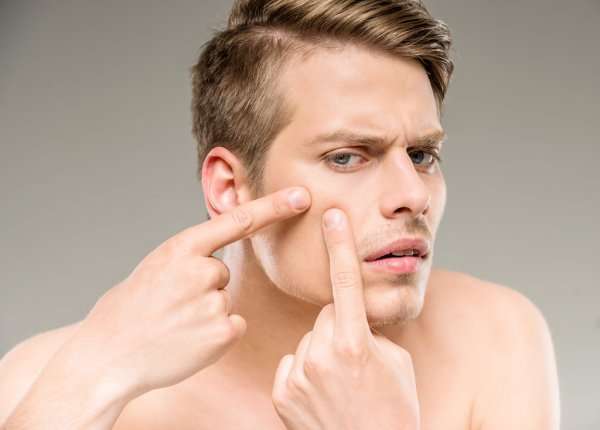 Men’s Guide to Dealing with Acne
