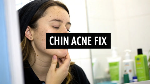 why am i breaking out on my chin: simple fixes that work