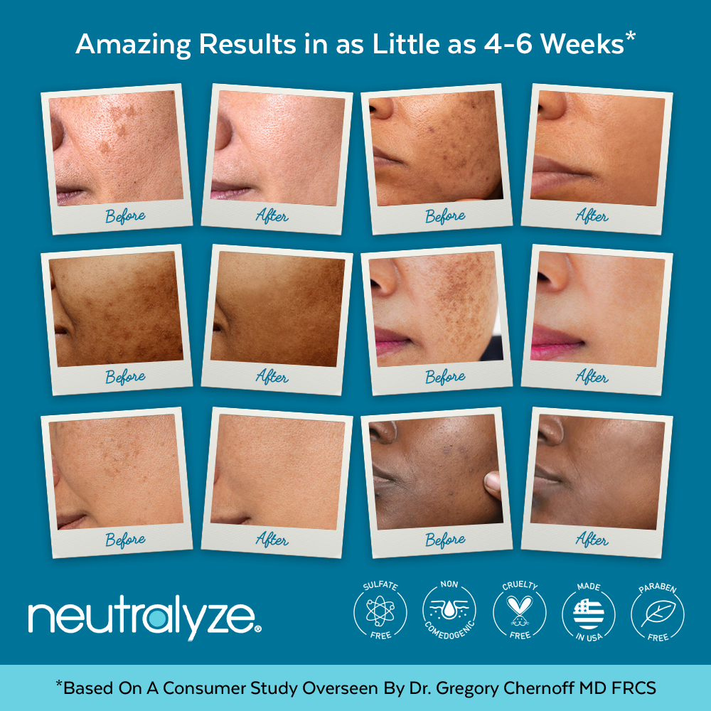 Best Acne Dark Spot Corrector for Acne Skin Neutralyze