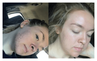 Before and after photos of a Neutralyze customer