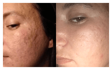 Before and after photos of a Neutralyze customer