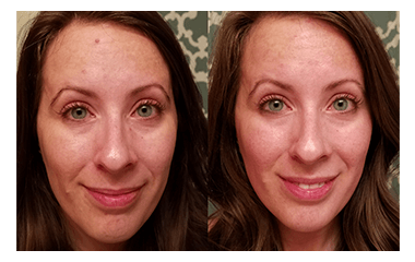 Before and after photos of a Neutralyze customer