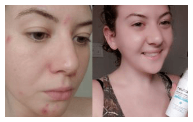 Before and after photos of a Neutralyze customer