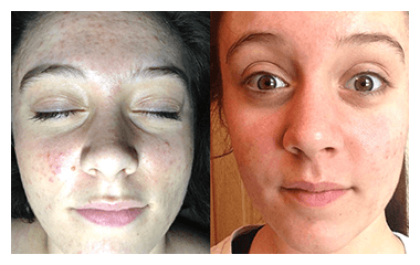 Before and after photos of a Neutralyze customer