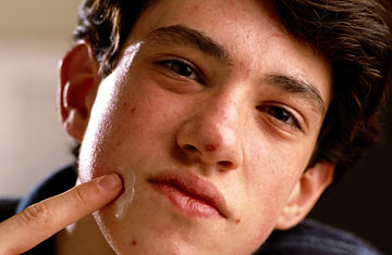 Teen Boys: Winning the Battle Against Acne