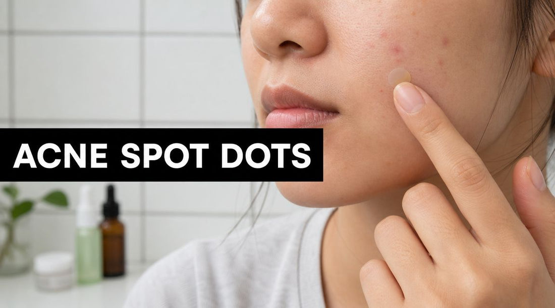 Acne Spot Dots: A Guide for Moderate to Severe Acne