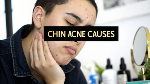 A Complete Guide to Understanding Chin Acne Causes