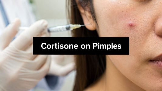 Cortisone on Pimples: Risks, Benefits, & Alternatives