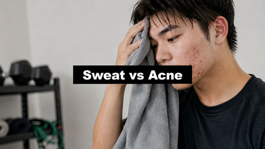 Does Sweating Help Acne or Make It Worse