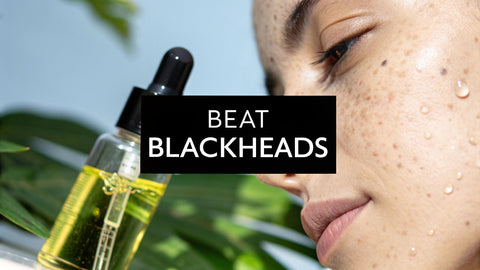 The Best Acne Treatment for Blackheads Uncovered