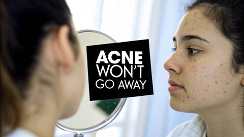 Why Acne Won't Go Away: Proven Tips for Clear Skin