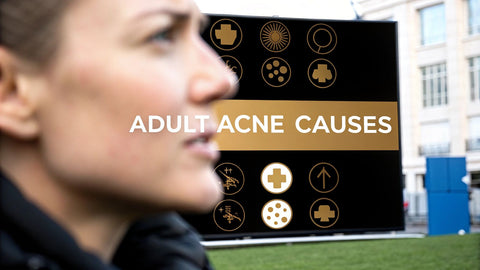What Causes Acne in Adults Explained