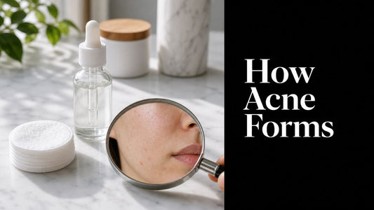 How Does Acne Form: The Science of Breakouts