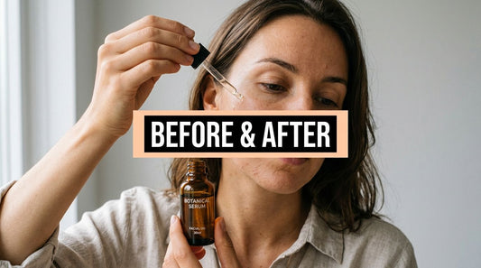 Mandelic Acid Before and After: Real Results Guide