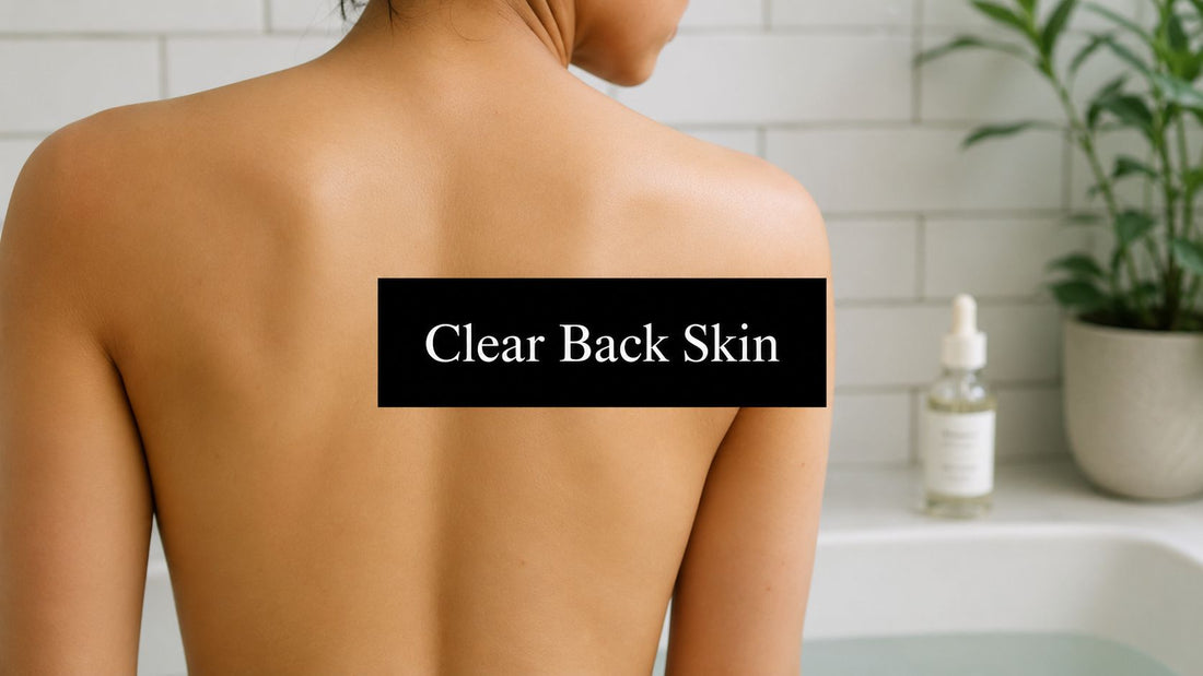 Salicylic Acid for Back Acne: Get Clear Skin in 2026