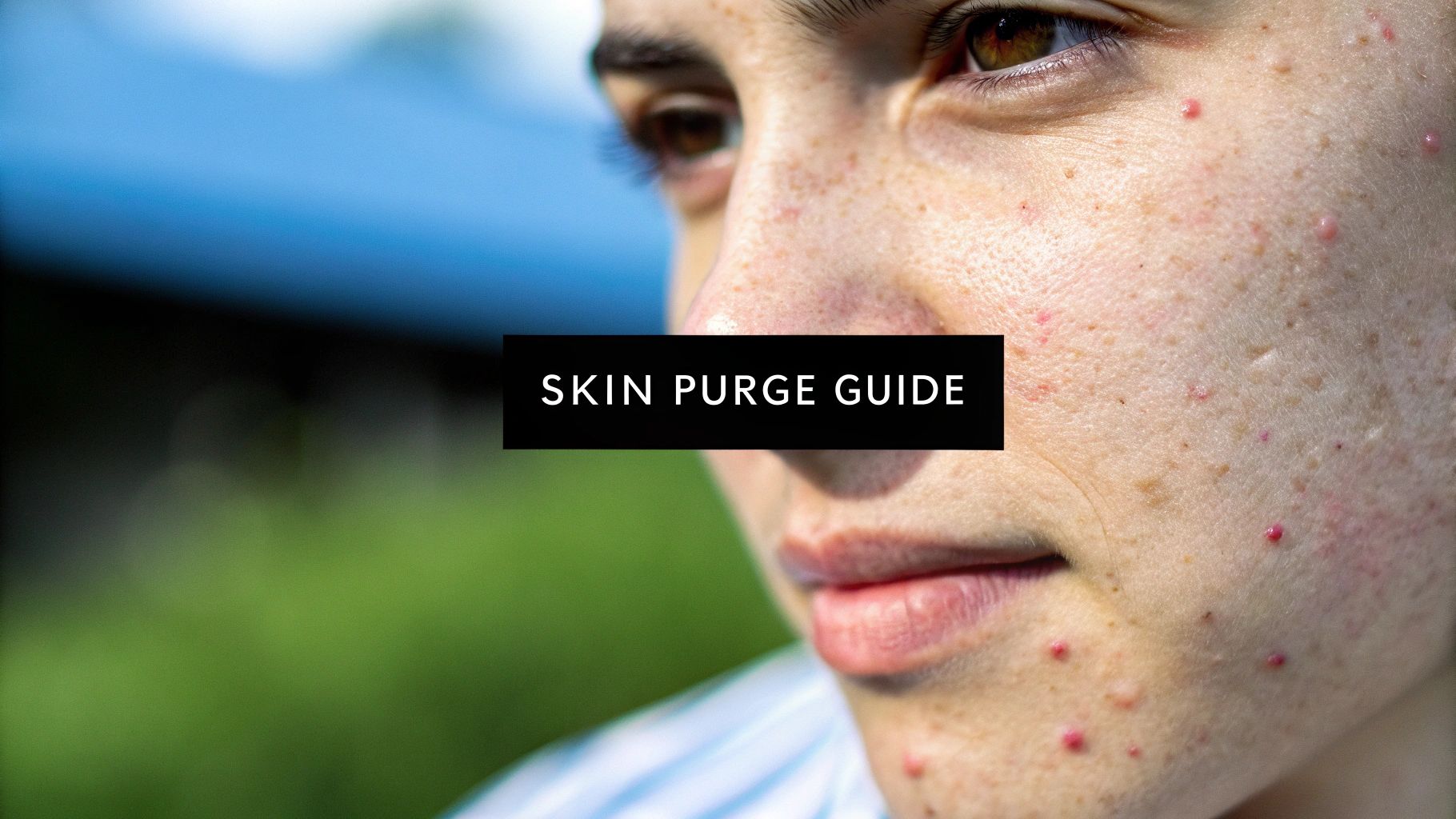 What Does Purging Skin Look Like? A Complete Visual Guide