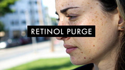 What Does Retinol Purge Look Like? A Visual Guide