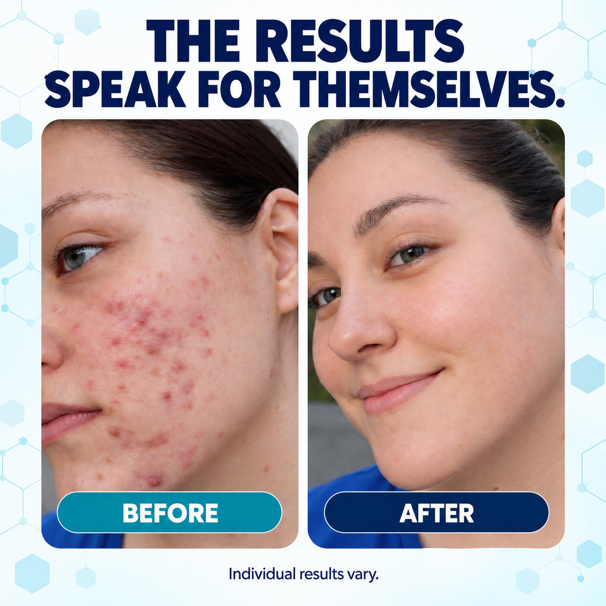 Neutralyze Renewal Complex - Before & After