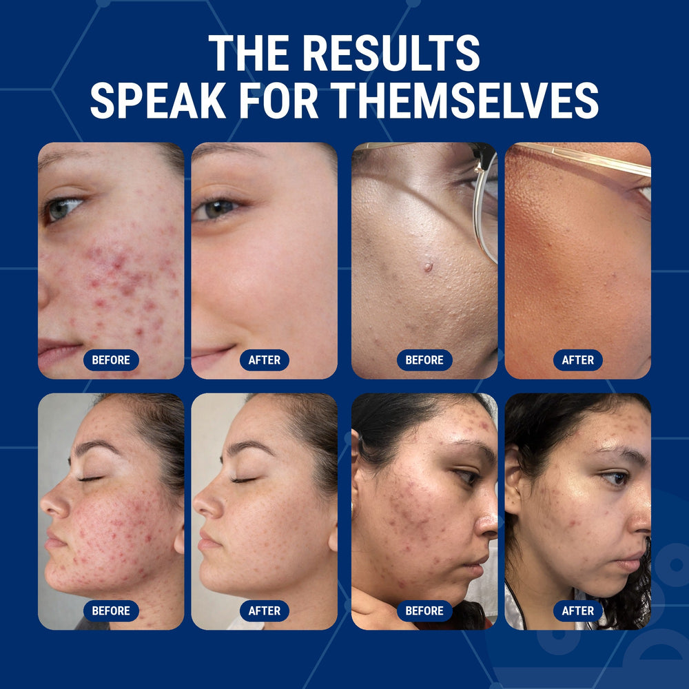 Four before and after photo pairs under the headline The results speak for themselves.