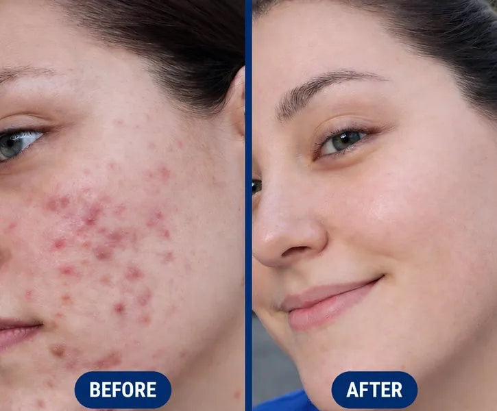 Before and after using Neutralyze Exfoliating Pads